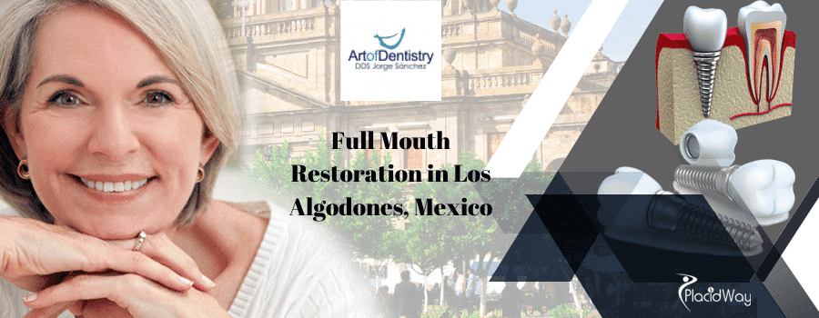 Full Mouth Restoration by Art of Dentistry in Los Algodones, Mexico